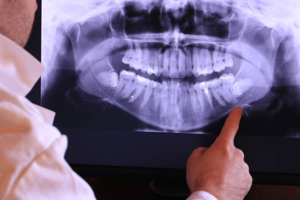 Best Mobile Emergency Dentist in Brunswick, GA